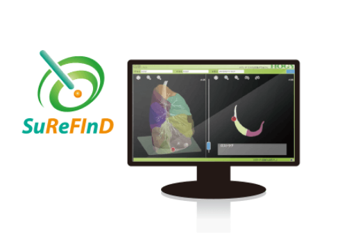 SuReFInD写真